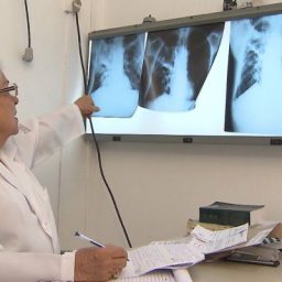 Salvador tem incidência de tuberculose acima da média nacional