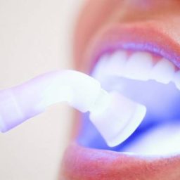 Clareamento dental é um dos procedimentos estéticos mais procurados durante o verão