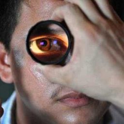 Inteligência artificial amplia diagnóstico de doenças oculares