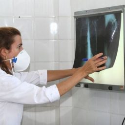 Tuberculose mata 4.500 pessoas todos os dias no mundo