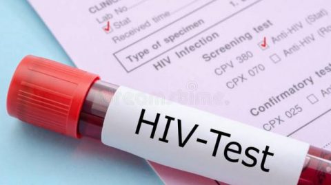 Brasil amplia diagnóstico de HIV e cumpre mais uma meta da ONU