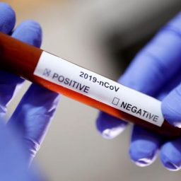 Cientistas desenvolvem medicamento contra coronavírus