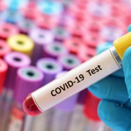 Você sabia que o trabalhador que testar positivo para o COVID-19 pode ter direto a Auxílio-doença ou Auxílio-acidente?