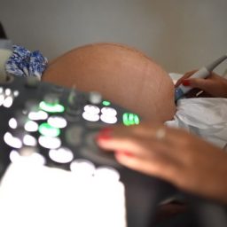 Ministério da Saúde recomenda adiar gravidez por causa da pandemia