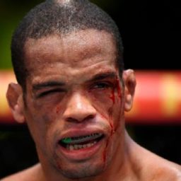 UFC começa com Alan ‘Nuguette’ levando dedada no olho e luta sem resultado