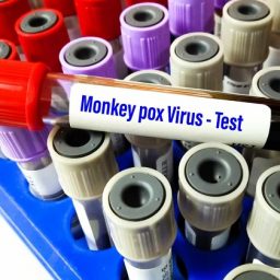 Varíola dos macacos terá novo nome devido os “estereótipos racistas”