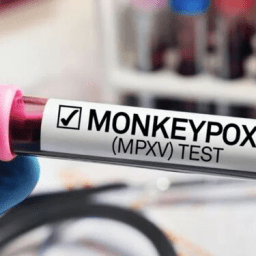 Ministério da Saúde confirma 106 casos de varíola dos macacos