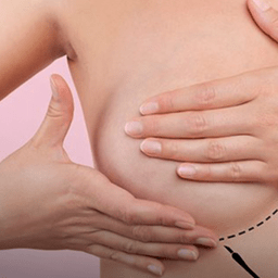 Pesquisa mostra queda em tratamento e diagnóstico de câncer de mama