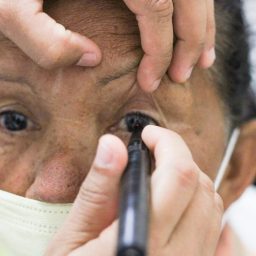 Conselho Brasileiro de Oftalmologia alerta para os riscos oculares em mutirões
