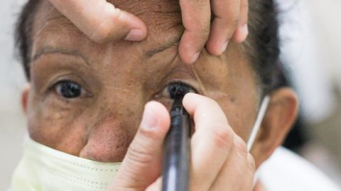 Conselho Brasileiro de Oftalmologia alerta para os riscos oculares em mutirões
