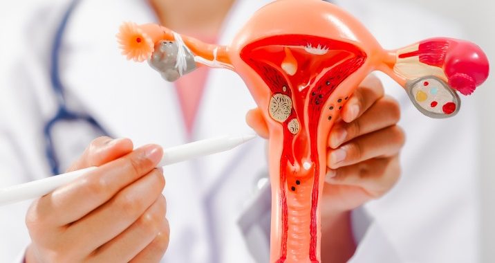 Brasil registra mais de 7 mil novos casos de câncer de ovário por ano